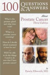 Produktbild: 100 Questions & Answers About Prostate Cancer