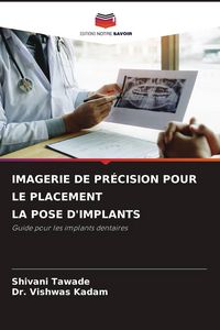 Produktbild: IMAGERIE DE PR&Eacute;CISION POUR LE PLACEMENT LA POSE D'IMPLANTS