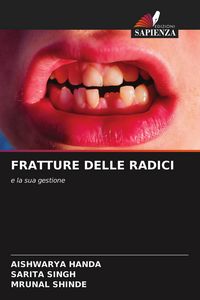 Produktbild: Fratture Delle Radici