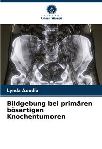 Produktbild: Bildgebung bei prim&auml;ren b&ouml;sartigen Knochentumoren