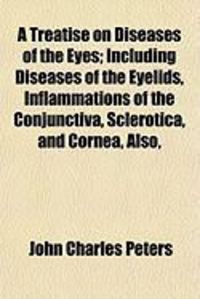 Produktbild: A Treatise on Diseases of the Eyes; Including Diseases of the Eyelids, Inflammations of the Conjunctiva, Sclerotica, and Cornea, Also,
