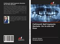 Produktbild: Fallimenti Nell'impianto Dentale- Un In-sito Ad Esso