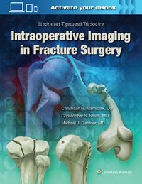 Produktbild: Illustrated Tips and Tricks for Intraoperative Imaging in Fracture Surgery