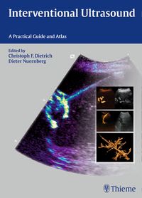 Produktbild: Interventional Ultrasound