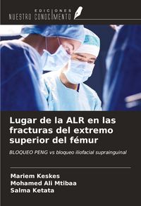 Produktbild: Lugar de la ALR en las fracturas del extremo superior del f&eacute;mur