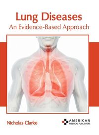 Produktbild: Lung Diseases: An Evidence-Based Approach
