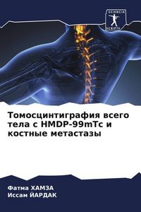 Produktbild: Tomoscintigrafiq wsego tela s HMDP-99mTc i kostnye metastazy