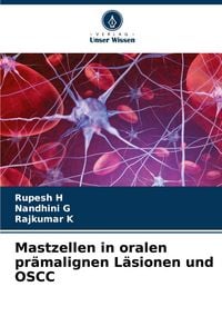 Produktbild: Mastzellen in oralen pr&auml;malignen L&auml;sionen und OSCC