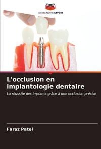 Produktbild: L'occlusion en implantologie dentaire