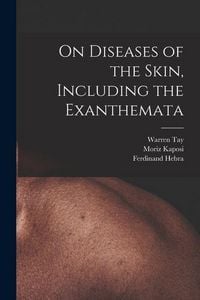 Produktbild: On Diseases of the Skin, Including the Exanthemata
