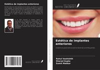 Produktbild: Est&eacute;tica de implantes anteriores