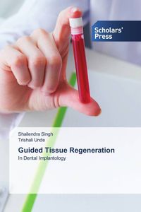 Produktbild: Guided Tissue Regeneration