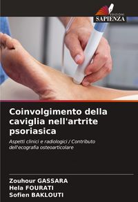 Produktbild: Coinvolgimento della caviglia nell'artrite psoriasica