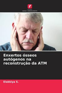 Produktbild: Enxertos &oacute;sseos aut&oacute;genos na reconstru&ccedil;&atilde;o da ATM