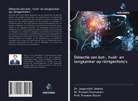 Produktbild: Detectie van bot-, huid- en longkanker op r&ouml;ntgenfoto's