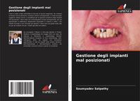 Produktbild: Gestione degli impianti mal posizionati