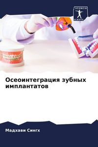 Produktbild: Oseointegraciq zubnyh implantatow