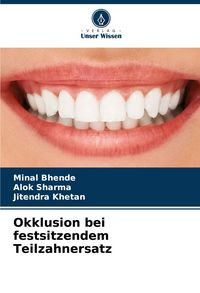 Produktbild: Okklusion bei festsitzendem Teilzahnersatz