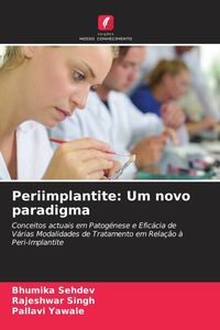Produktbild: Periimplantite: Um novo paradigma