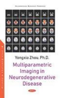 Produktbild: Zhou, Y: Multiparametric Imaging in Neurodegenerative Diseas