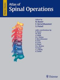 Produktbild: Atlas of Spinal Operations