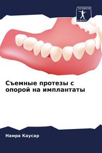 Produktbild: S#emnye protezy s oporoj na implantaty