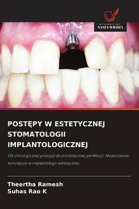Produktbild: Post&iquest;py W Estetycznej Stomatologii Implantologicznej