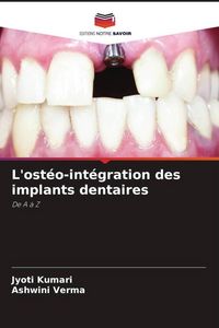 Produktbild: L'ost&eacute;o-int&eacute;gration des implants dentaires