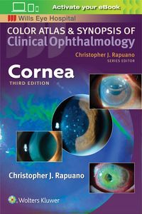 Produktbild: Rapuano, C: Cornea
