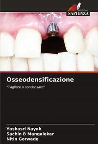 Produktbild: Osseodensificazione