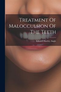 Produktbild: Treatment Of Malocculsion Of The Teeth