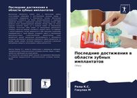 Produktbild: Poslednie dostizheniq w oblasti zubnyh implantatow