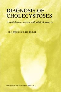 Produktbild: Diagnosis of Cholecystoses