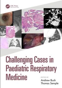Produktbild: Challenging Cases in Paediatric Respiratory Medicine