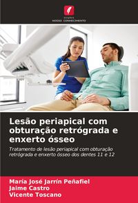 Produktbild: Les&atilde;o periapical com obtura&ccedil;&atilde;o retr&oacute;grada e enxerto &oacute;sseo