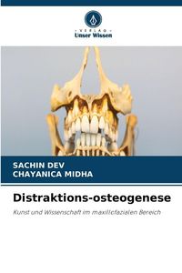 Produktbild: Distraktions-osteogenese