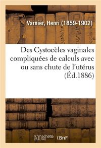 Produktbild: Des Cystoc&egrave;les Vaginales Compliqu&eacute;es de Calculs Avec Ou Sans Chute de l'Ut&eacute;rus
