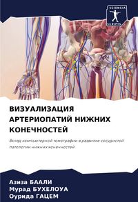 Produktbild: Vizualizaciya Arteriopatij Nizhnih Konechnostej
