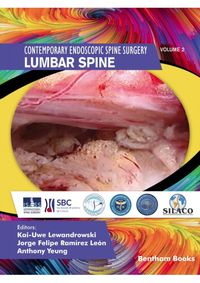 Produktbild: Lumbar Spine
