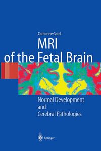 Produktbild: MRI of the Fetal Brain