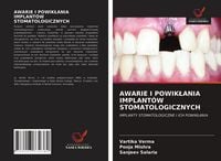 Produktbild: Awarie I Powik&iquest;ania Implant&oacute;w Stomatologicznych