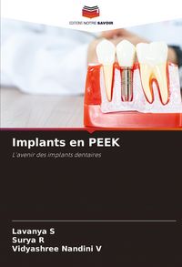 Produktbild: Implants en PEEK