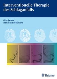 Produktbild: Interventionelle Therapie des Schlaganfalls