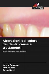 Produktbild: Alterazioni del colore dei denti: cause e trattamenti