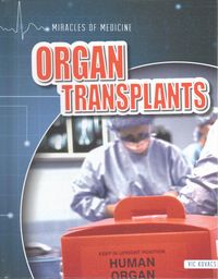 Produktbild: Organ Transplants