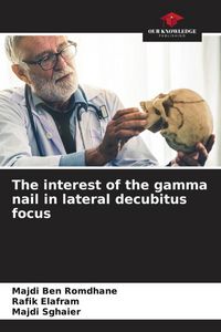 Produktbild: The interest of the gamma nail in lateral decubitus focus