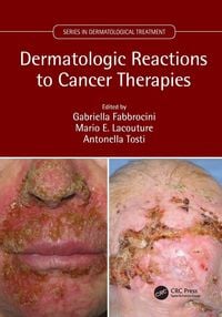 Produktbild: Dermatologic Reactions to Cancer Therapies
