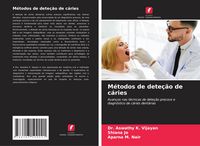 Produktbild: M&eacute;todos de dete&ccedil;&atilde;o de c&aacute;ries