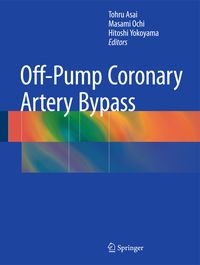 Produktbild: Off-Pump Coronary Artery Bypass