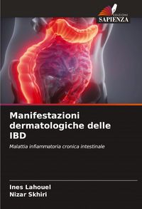 Produktbild: Manifestazioni dermatologiche delle IBD